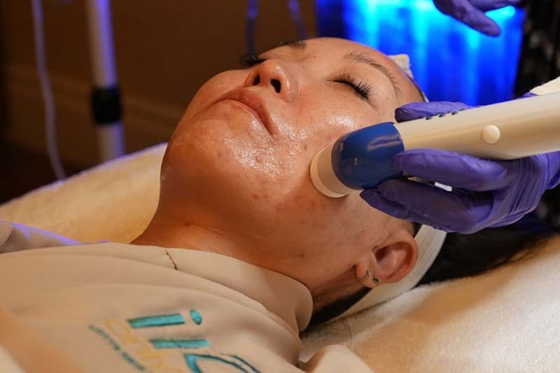 Advanced HydraFacial treatment performed at ila Only Spa in Midtown Manhattan New York