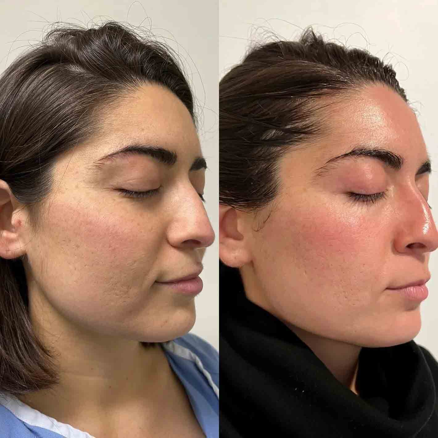 Side-by-side facial photographs showing differences in skin texture, smoothness, and complexion.